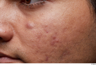 HD Face Skin Ithamar Jung cheek face skin pores skin…